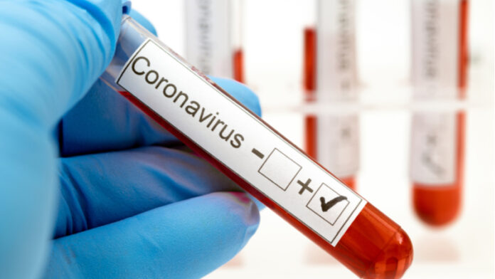 coronavirus-test
